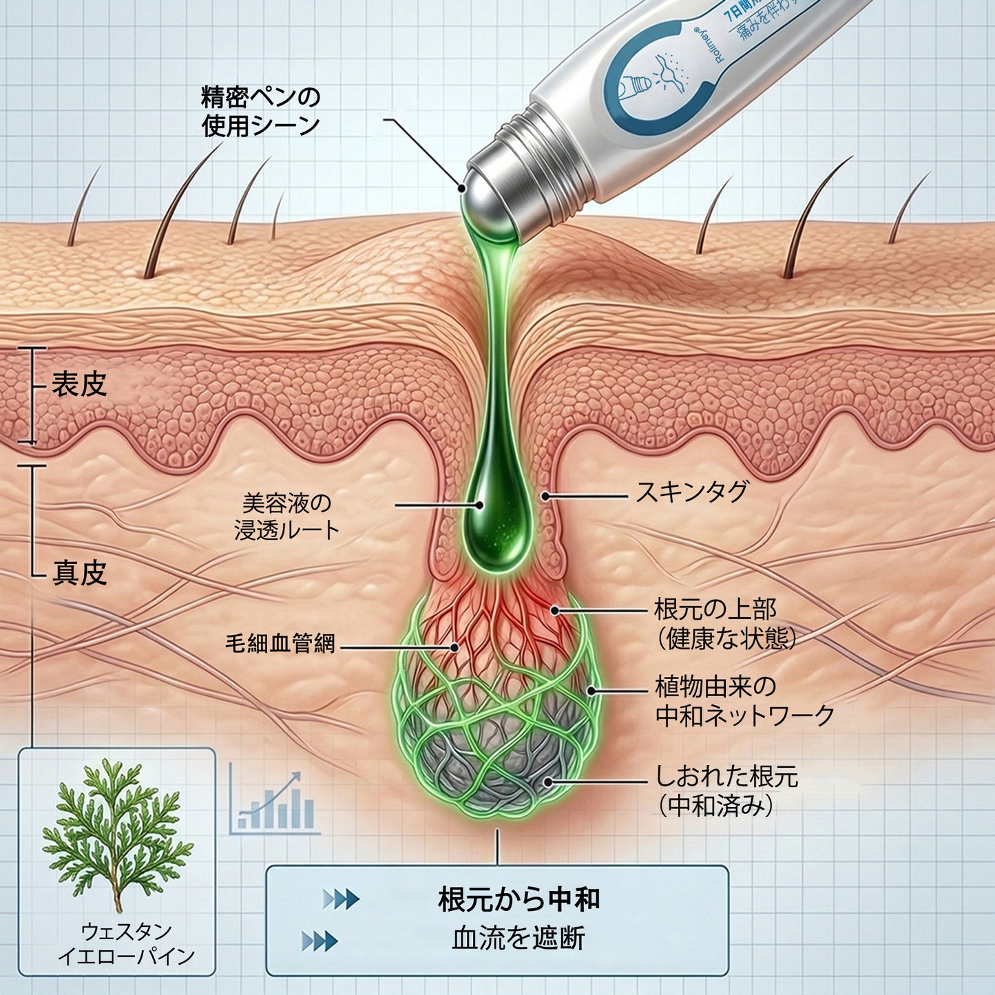 公式ショップ ✅｜Rolimey® 7日間集中ケア 肌のイボ・角質粒・シミのような色ムラケアに特化した美容パッチ👩‍⚕️ （痛みなし・傷跡なし・正確に塗布できるロールオンアプリケーター）🔥