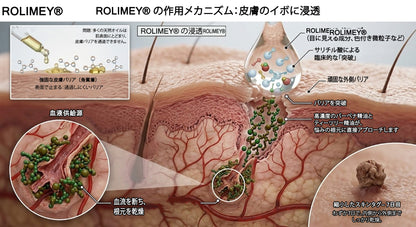 公式ショップ ✅｜Rolimey® 7日間集中ケア 肌のイボ・角質粒・シミのような色ムラケアに特化した美容パッチ👩‍⚕️ （痛みなし・傷跡なし・正確に塗布できるロールオンアプリケーター）🔥
