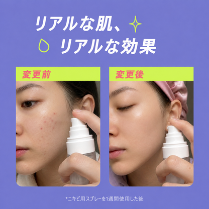 ✨✨東京発・ニキビケア Celsiora®