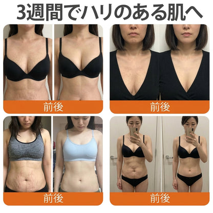 🧑‍⚕️DR. Fachmer®ビーベノム リペア再生クリーム🔥天然由来のエイジングケアで肌を引き締め、ハリを与え、乾燥による小ジワを目立たなくします – 50mL