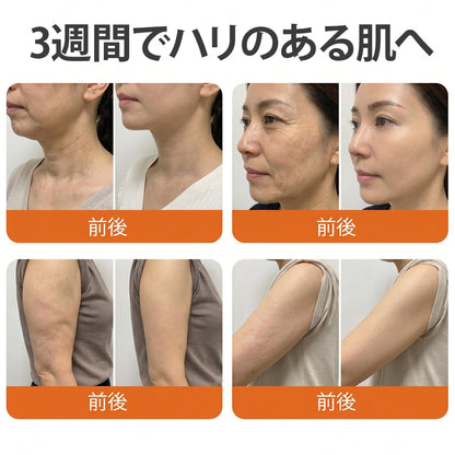 🧑‍⚕️DR. Fachmer®ビーベノム リペア再生クリーム🔥天然由来のエイジングケアで肌を引き締め、ハリを与え、乾燥による小ジワを目立たなくします – 50mL